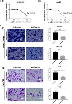 Matrix Stiffness-Upregulated MicroRNA-17-5p Attenuates the Intervention Effects of Metformin on HCC Invasion and Metastasis by Targeting the PTEN/PI3K/Akt Pathway